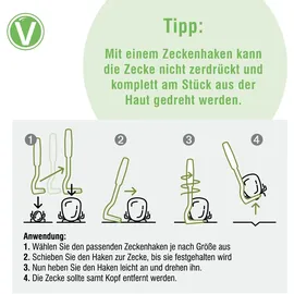 Vetlando Zeckenhaken Zeckenzange 3 Stück