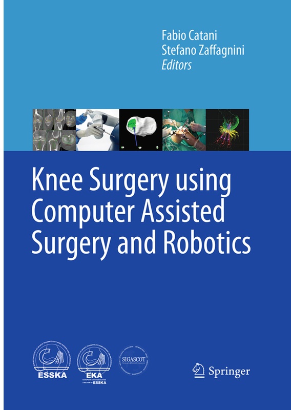 Knee Surgery Using Computer Assisted Surgery And Robotics, Kartoniert (TB)