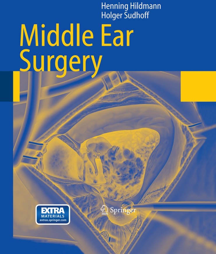 Middle Ear Surgery - Henning Hildmann  Holger Sudhoff  Kartoniert (TB)
