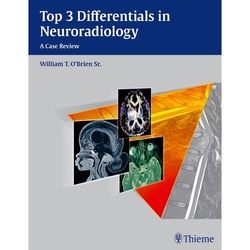 Top 3 Differentials / Top 3 Differentials In Neuroradiology - William T. O'Brien, Kartoniert (TB)