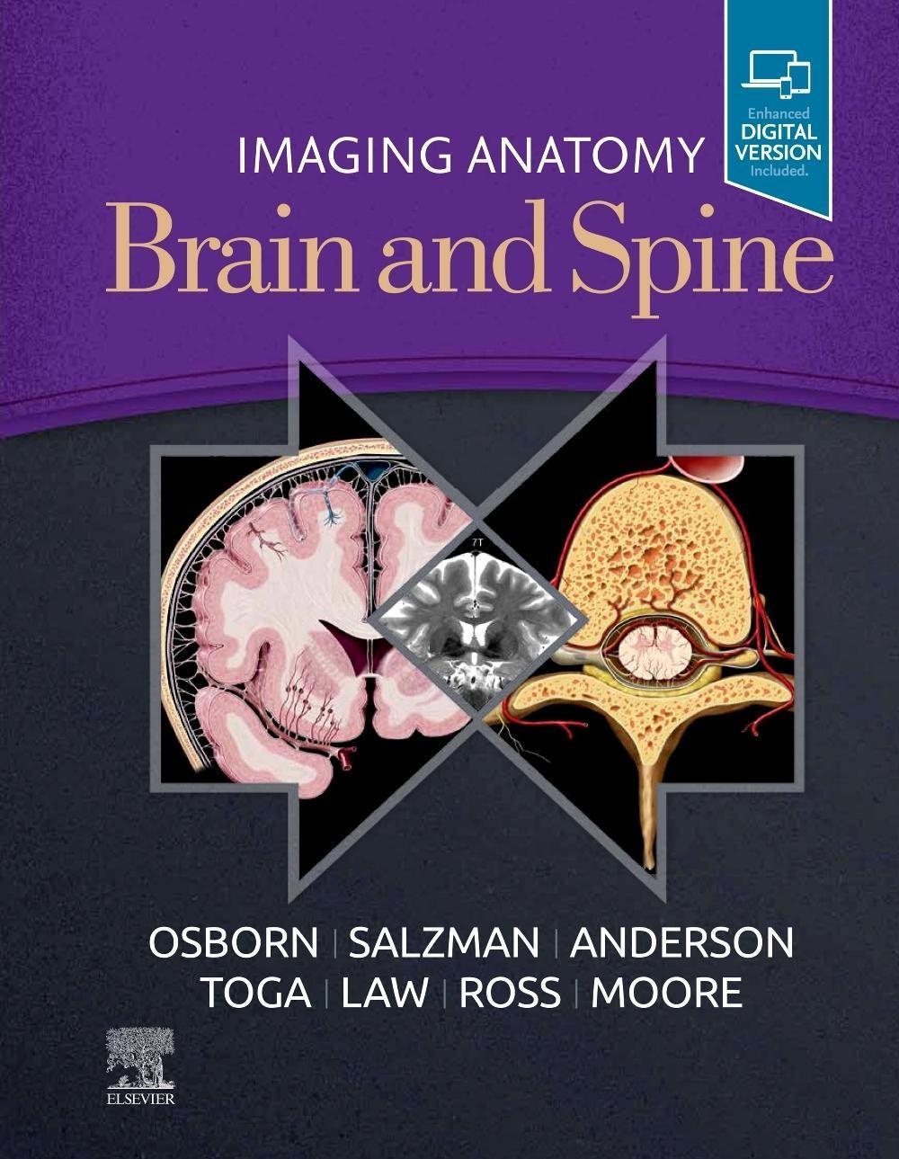 Imaging Anatomy Brain And Spine - Anne G. Osborn  Karen L. Salzman  Jeffrey S Anderson  Arthur W. Toga  Meng Law  Jeffrey Ross  Kevin R. Moore  Gebund