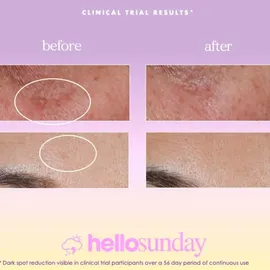Hello Sunday the one that makes you glow Dark Spot Serum SPF 40 30 ml