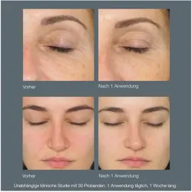 Dermalogica Daily Milkfoliant Gesichtspeeling 74 g