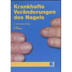 Krankhafte Veränderungen des Nagels