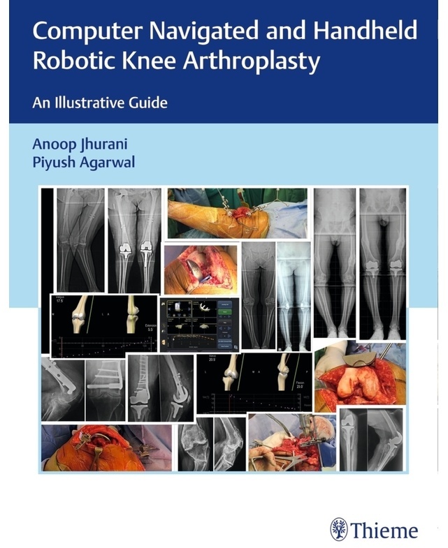 Computer Navigated And Handheld Robotic Knee Arthroplasty - Anoop Jhurani  Piyush Agarwal  Gebunden