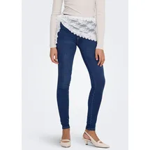 Only Royal High Skinny Fit Jeans