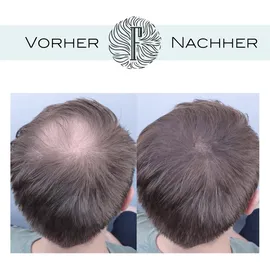 Fidentia Haar Concealer Shader | Dunkles Mittelbraun