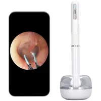 Ohrenschmalz-Entfernungswerkzeug, Ohrenreiniger mit Kamera und LED-Licht, Sichtbares Ohrkamera-Otoskop, 10 MP 360-Grad-Weitwinkel-Ohrenschmalz-Entferner-Picker (Weiss)