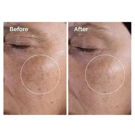 The Ordinary Glycolic Acid 7% Exfoliating Toner 100 ml