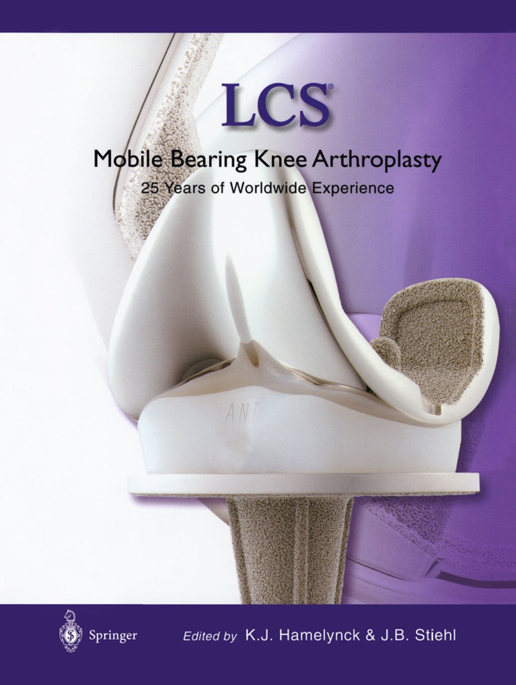 Lcs® Mobile Bearing Knee Arthroplasty  Kartoniert (TB)