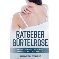 Ratgeber Gürtelrose