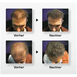 BioTHIK Haaraufbau-Faser S8 wheat blond 25g Alkoholfrei Pulver Haarwuchs und Haarverdickung Unisex-Erwachsene