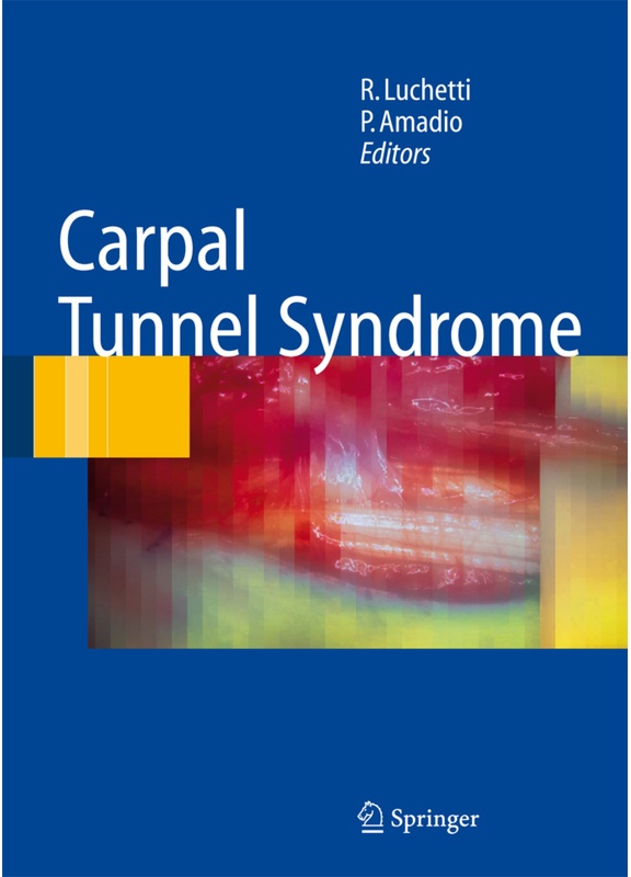 Carpal Tunnel Syndrome  Kartoniert (TB)