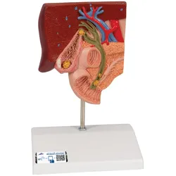 Gallensteinmodell - 3B Smart Anatomy