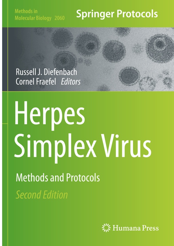 Herpes Simplex Virus, Kartoniert (TB)