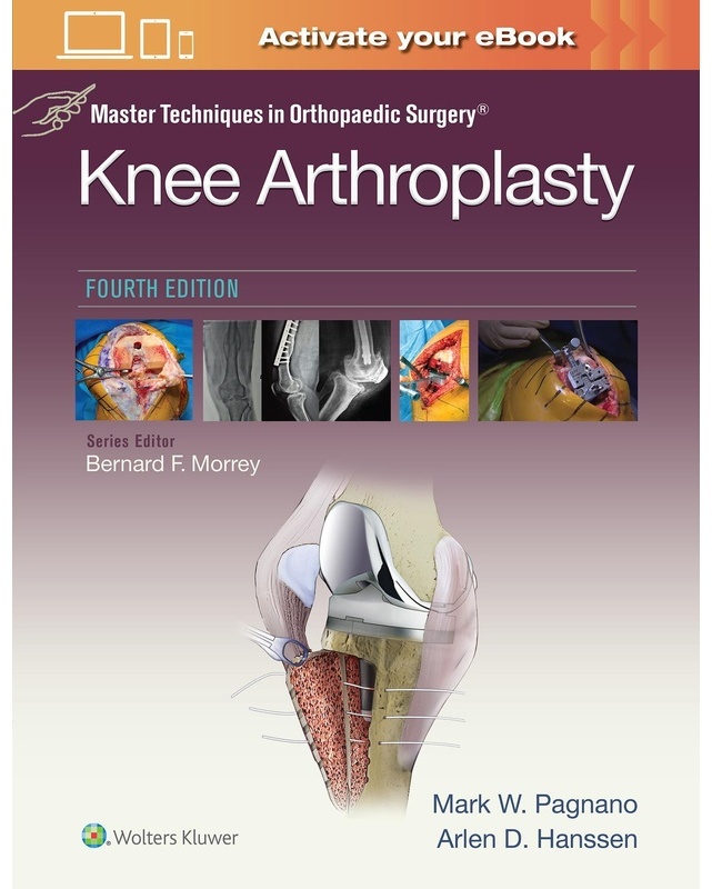 Master Techniques In Orthopedic Surgery: Knee Arthroplasty (Master Techniques In Orthopaedic Surgery) - Mark W. Pagnano  Arlen D. Hanssen  Gebunden
