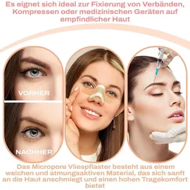 P-Beauty Cosmetic Accessories 3M Micropore Vliespflaster Hautfarben für Haut & Wimpern 1,25cm x 9,14m, 5 Rollen)
