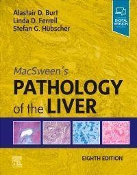 Macsween's Pathology Of The Liver - Alastair D. Burt  Linda D. Ferrell  Stefan G. Hübscher  Gebunden