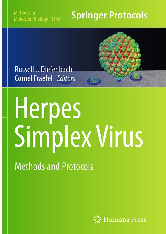 Herpes Simplex Virus  Kartoniert (TB)