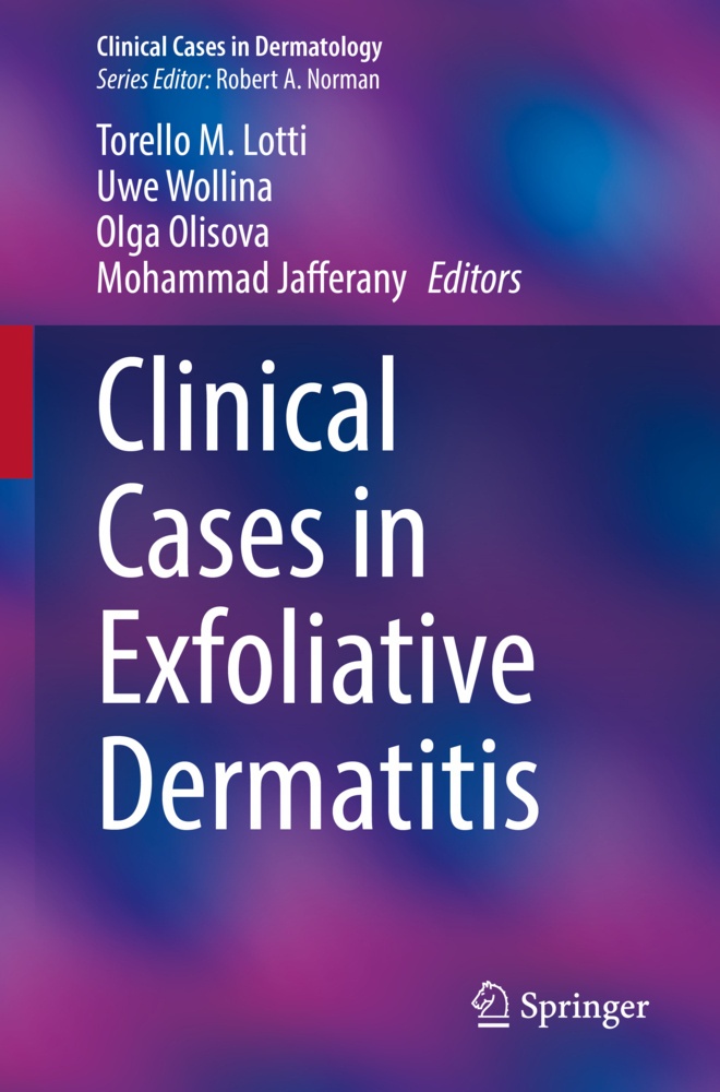 Clinical Cases In Exfoliative Dermatitis  Kartoniert (TB)