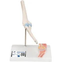 Mini Anatomie Modell Ellenbogengelenk, mit Querschnitt - 3B Smart Anatomy