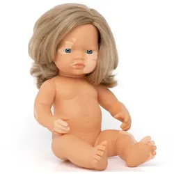 miniland dolls Babypuppe europäisches Mädchen ohne Kleidung, mit Pigmentstörung