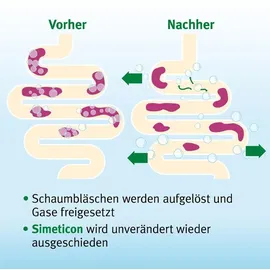 BERLIN-CHEMIE ESPUMISAN Gold Perlen gegen Blähungen 20 St.