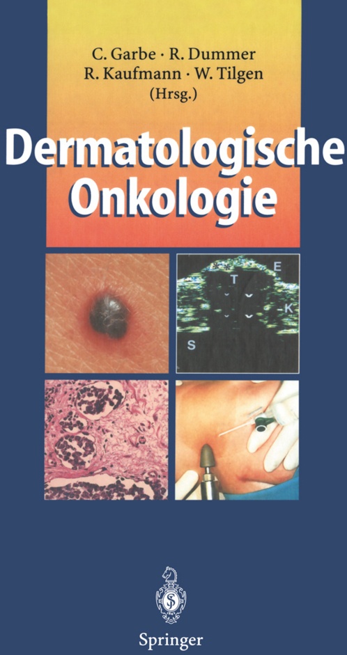 Dermatologische Onkologie  Kartoniert (TB)