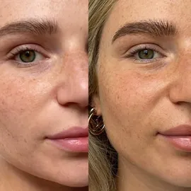 TAN-LUXE The Face Medium/Dark Selbstbräunungsserum