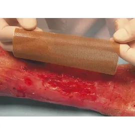 Urgo Medical Wundgaze 10 x 12 cm 10 St.
