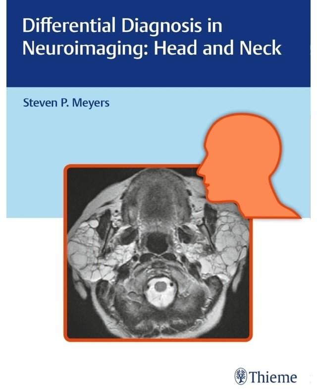 Differential Diagnosis In Neuroimaging / Differential Diagnosis In Neuroimaging: Head And Neck; ., Gebunden