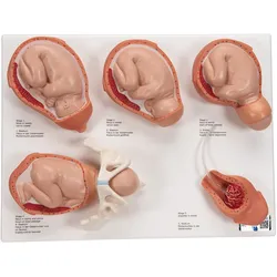 Geburtsstadien Modell - 3B Smart Anatomy