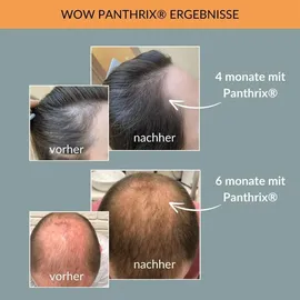 SnS Commerce GmbH Panthrix Haarwuchs Aktivator Tonikum