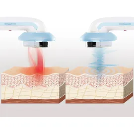 InnovaGoods InnovaGoods® Anti-Cellulite-Massagegerät Cellymax mit ultraschallbasiertem Kavitationsverfahren, Infrarot und Elektrostimulation 3-in-1. Anti Cellulite, Massagegerät