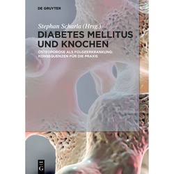 Diabetes Mellitus Und Knochen, Gebunden