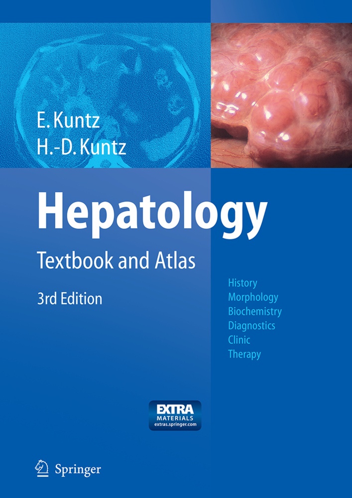 Hepatology - Erwin Kuntz  Hans-Dieter Kuntz  Kartoniert (TB)