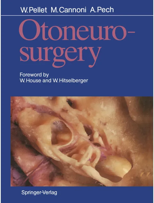 Otoneurosurgery - William Pellet, Maurice Cannoni, Andre Pech, Kartoniert (TB)
