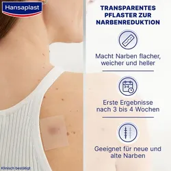 HANSAPLAST Pflaster zur Behandlung von Narben 21 St.