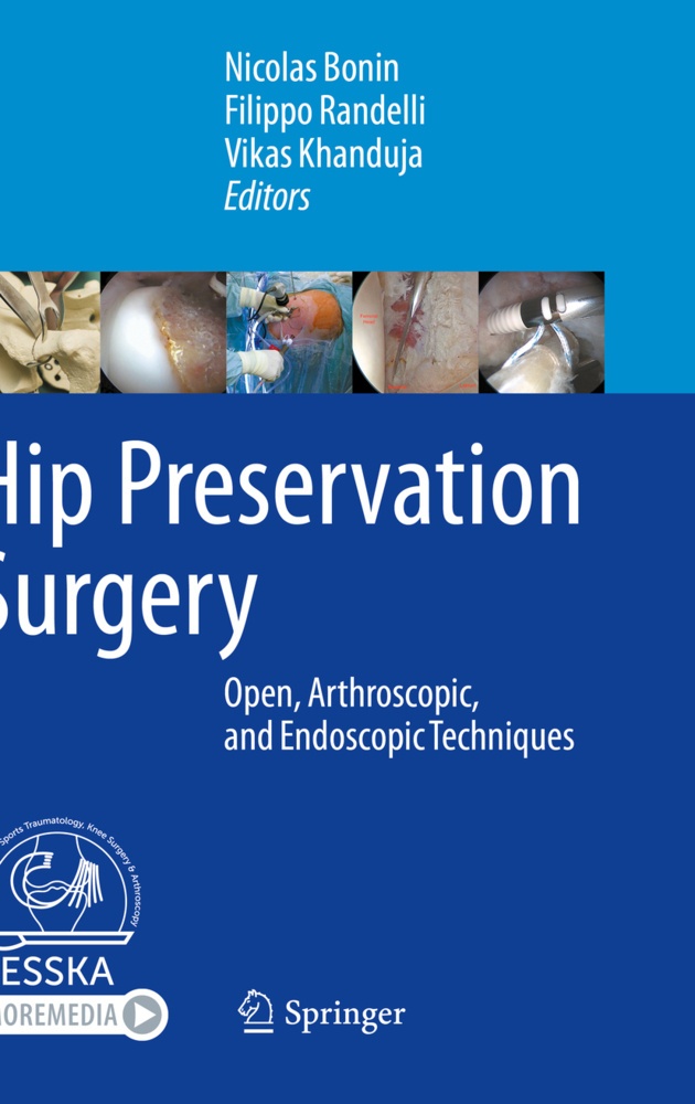 Hip Preservation Surgery  Kartoniert (TB)