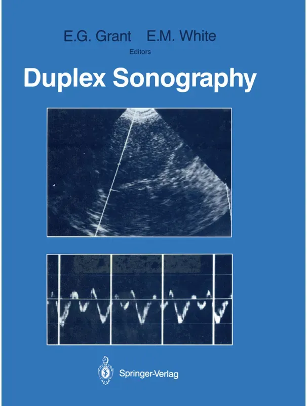 Duplex Sonography  Kartoniert (TB)