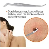 Helperfect Premium 2in1 Edelstahl Zeckenzange 1 Stück