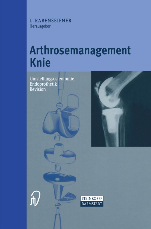 Arthrosemanagement Knie  Kartoniert (TB)