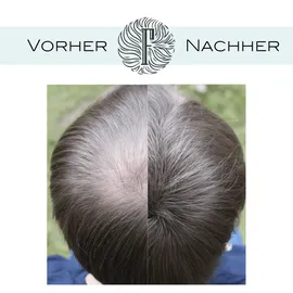 Fidentia Premium Schütthaar 10 g dunkelbraun