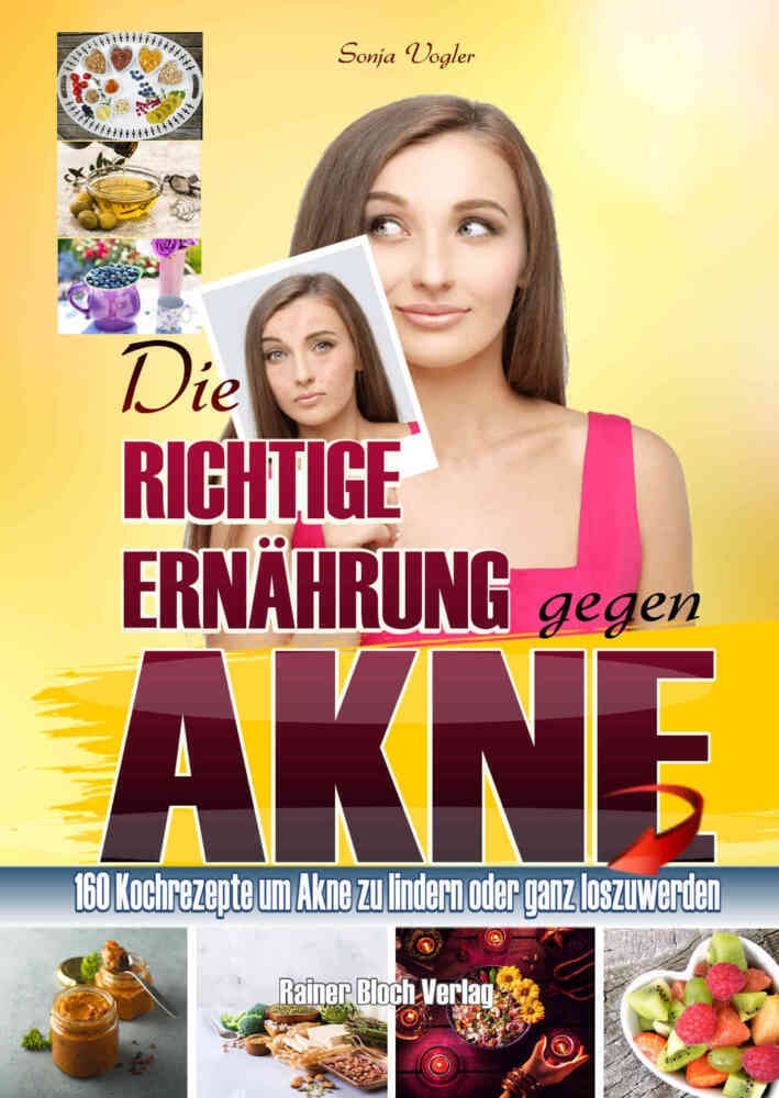Die Richtige Ernährung Gegen Akne - Sonja Vogler  Kartoniert (TB)