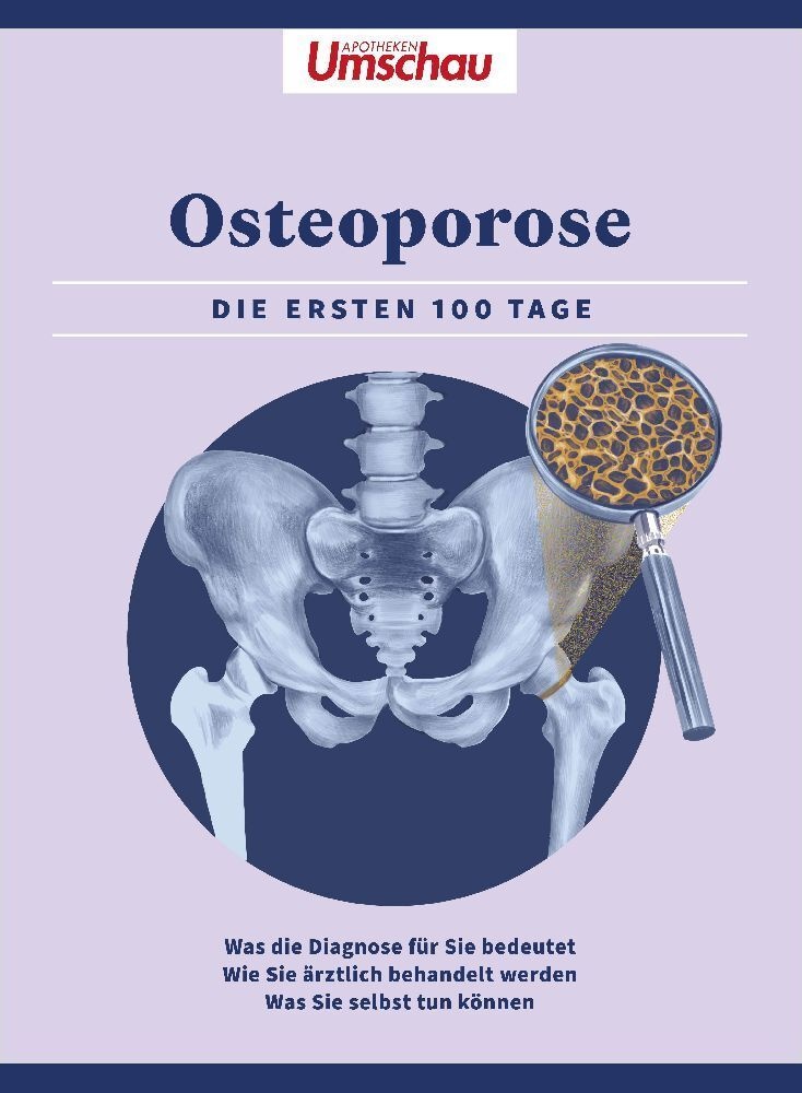 Apotheken Umschau: Osteoporose  Kartoniert (TB)