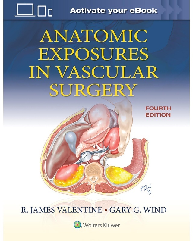 Anatomic Exposures In Vascular Surgery - Gary G. Wind, James Valentine, Gebunden