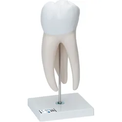 Zahnmodell Oberer Dreiwurzeliger Mahlzahn, 6-teilig - 3B Smart Anatomy