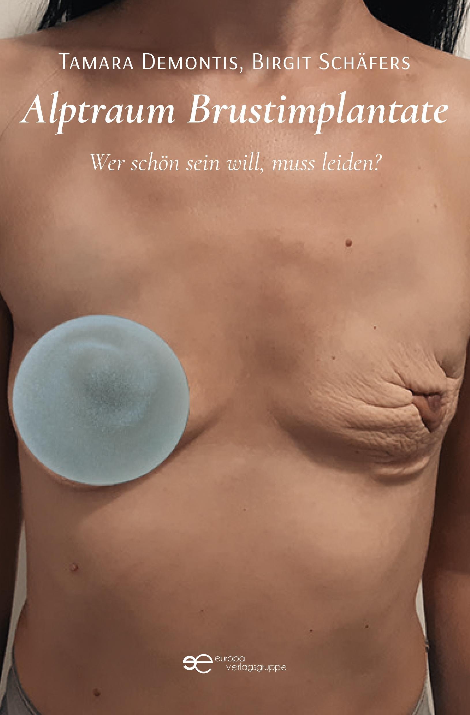 Alptraum Brustimplantate - Tamara Demontis  Birgit Schäfers  Kartoniert (TB)