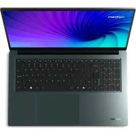 Medion 43,9 cm (17,3 Zoll Full HD) S20 Laptop (Intel Core Ultra 5 125H, 16GB DDR5 RAM, 1TB SSD, 100% sRGB, HD Webcam, WLAN, Win 11)