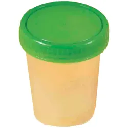 Urinbecher mit Schraubdeckel 1 St